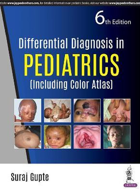 Short Textbook of Pediatrics