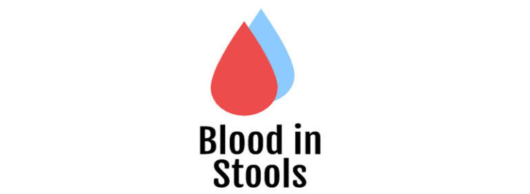 Blood in Stools